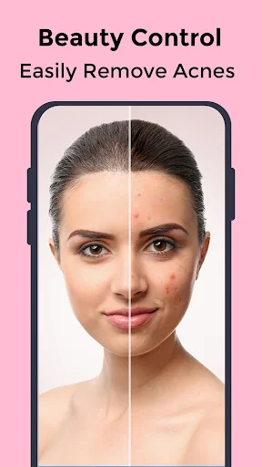 Beauty Control acne removal feature with before and after skin blemish editing on a woman's face
